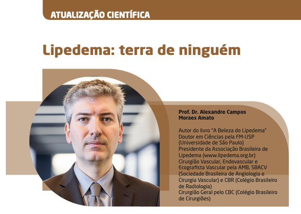 Imagem de Lipedema: terra de ninguém